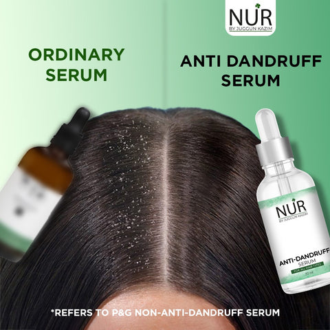 Anti-Dandruff Serum – Smoothing Hydrating Formula with Heat Protection for Dry, Frizzy & Damaged Hair